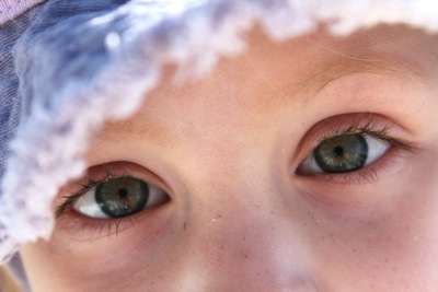 Freckled Cheeks